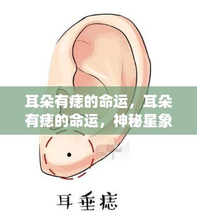 耳朵痣相与命运,神秘星象与身体印记的奥秘联系