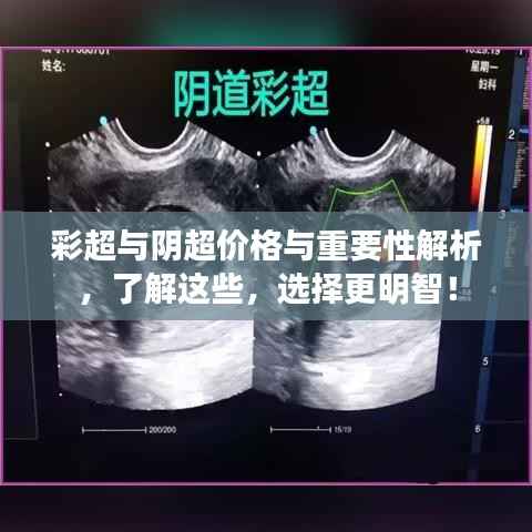 彩超与阴超价格与重要性解析,了解这些,选择更明智!